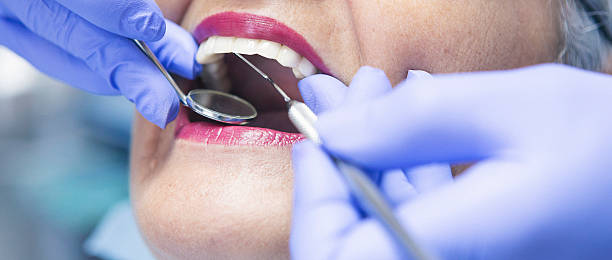 Best Broken or Chipped Tooth Repair in Briarcliff, TX